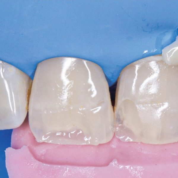 Atelier Stratification du composite