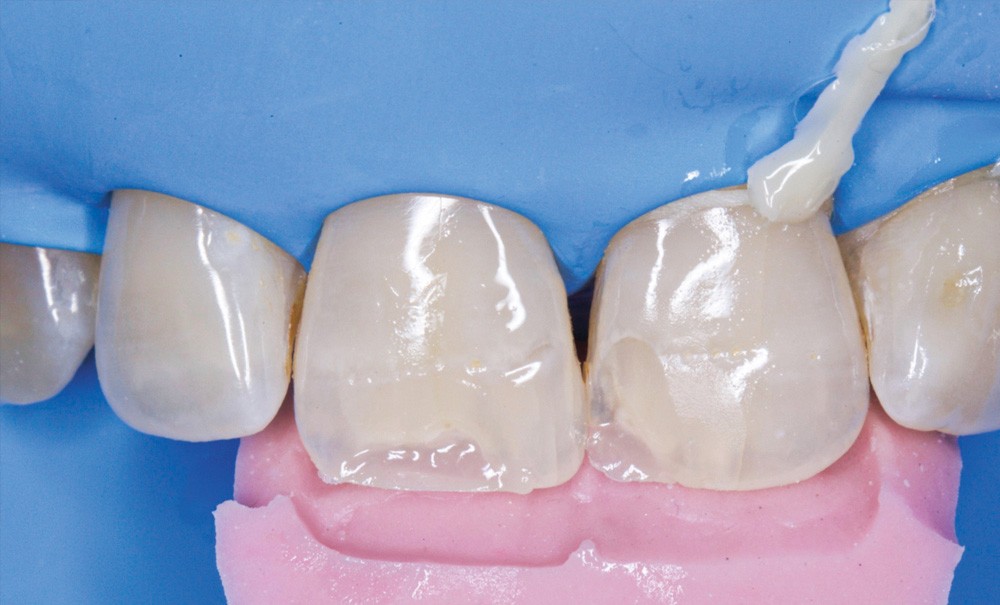 Atelier Stratification du composite